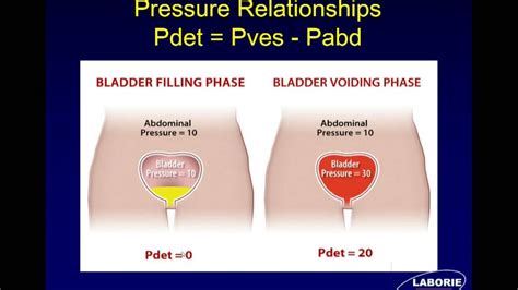 urodynamic bladder test results